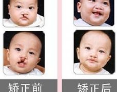 吃兔肉真的會長兔唇？為什么會長兔唇？